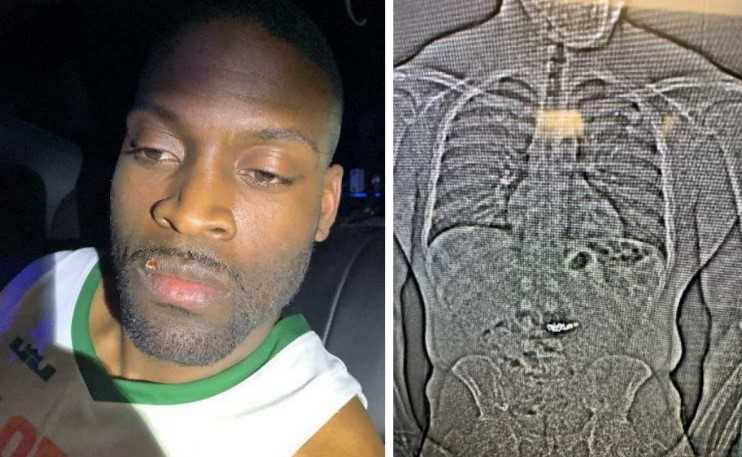 Florida man who swallowed nearly $1M in stolen jewelry found guilty of robbery — Harrisburg Community news